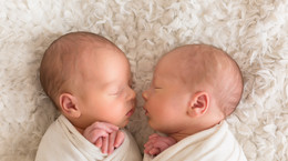 Wyjątkowe bliźnięta. Taki poród zdarza się raz na 1-2 miliony