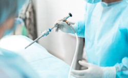 Zbyt mało zabiegów w Polsce wykonywanych jest laparoskopowo