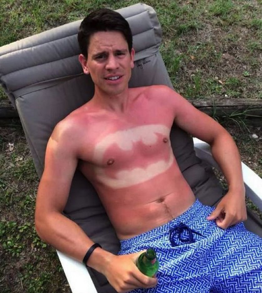 Sunburn Art