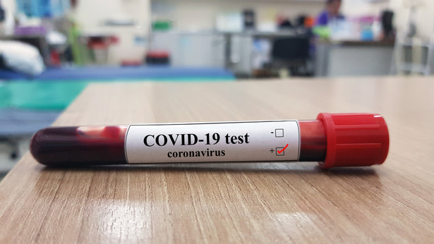 Obecnie na Warmii i Mazurach jest 11 chorych, u których zdiagnozowano koronawirusa