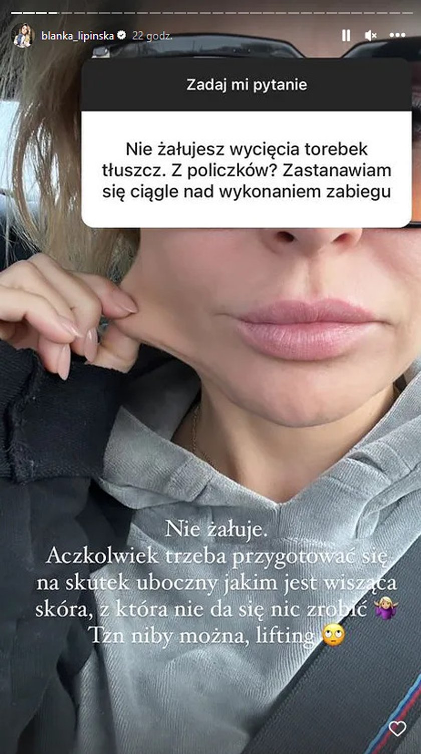 Blanka Lipińska pokazała fałdę skóry po wycięciu tłuszczu z policzka