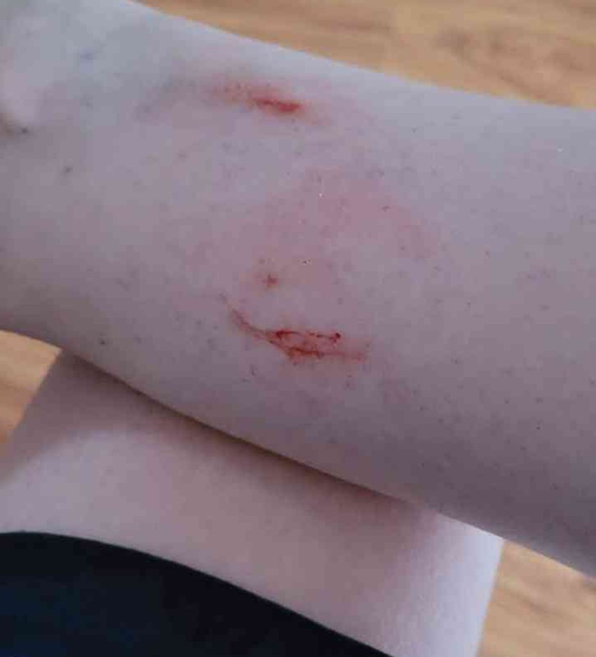 Žitelji Osečine zadobili povrede