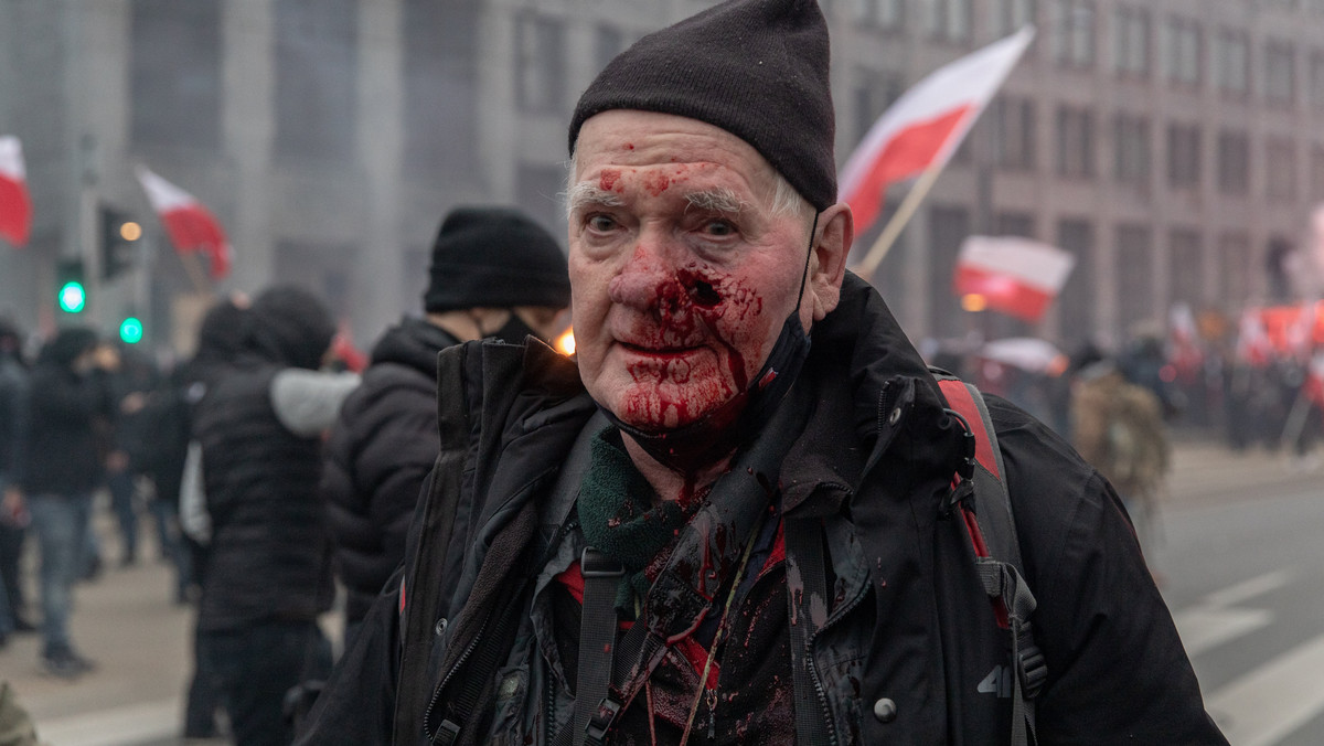 Marsz Niepodległości. Podczas starć postrzelono fotoreportera