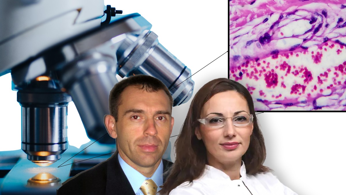 Uznapredovali Hočkinov limfom u Srbiji i dalje odnosi živote koje bi savremena terapija mogla da spasi, kažu dr Predrag Đurđević i dr Mila Purić