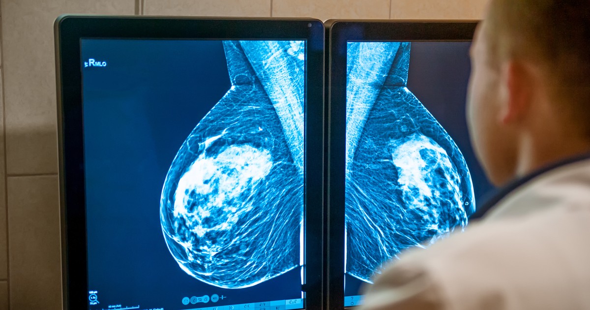 A co, jeśli rak piersi jest w twoich genach? Dyrektorka kliniki specjalistycznej odpowiada na palące kwestie