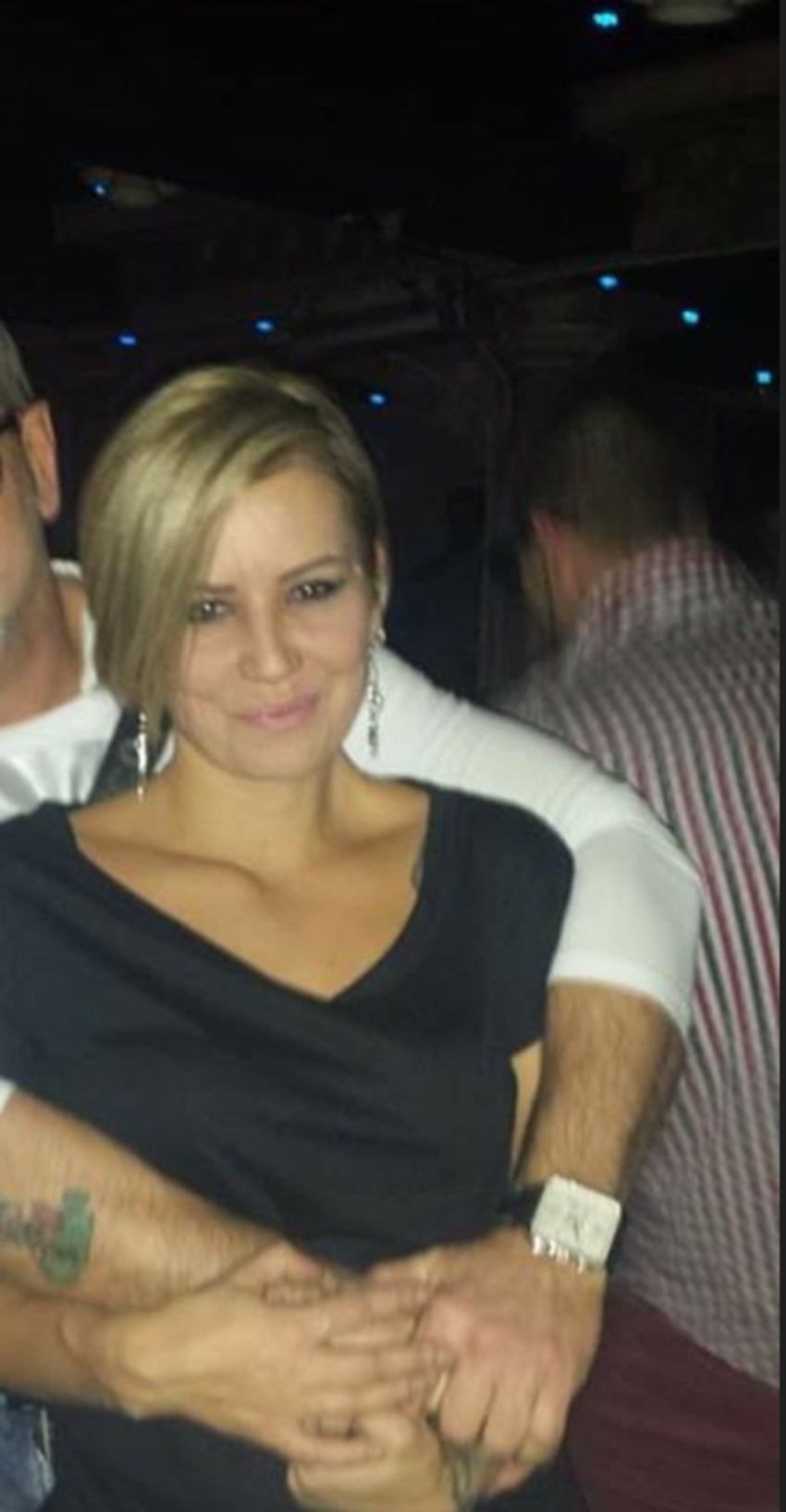 Alis Adaktar pre plastičnih operacija