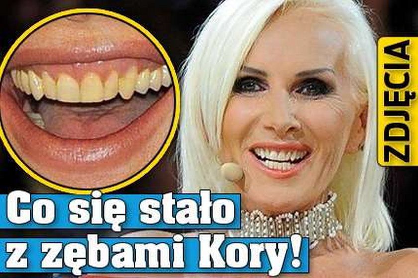 Co się stało z zębami Kory! ZDJĘCIA