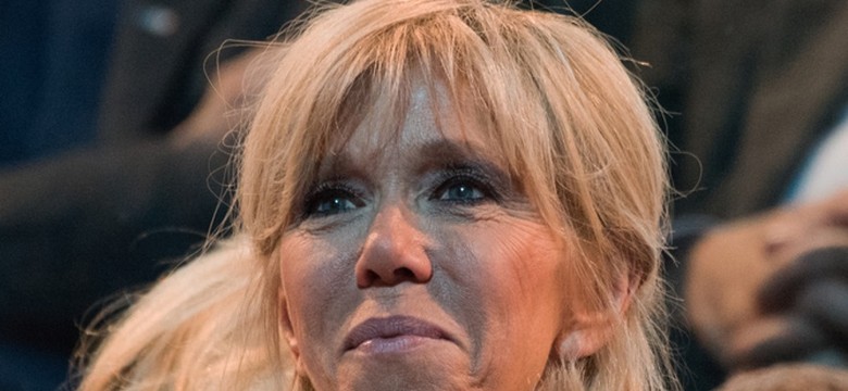 Doktor Gojdź "wyczytał" z twarzy Brigitte Macron, jakie zabiegi upiększające robiła...