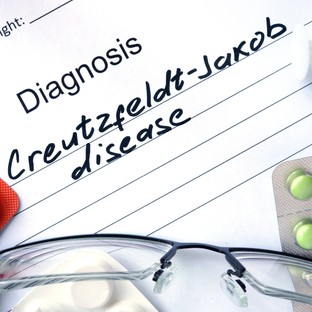 Creutzfeld-Jacob kór: tünetei, vizsgálata és kezelési lehetőségei