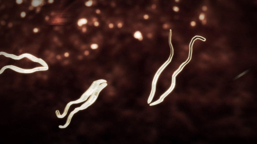 Trypanosoma brucei rhodesiense, czyli świdrowiec rodezyjski – ten śmiertelnie groźny pasożyt jest przenoszony przez muchę tse-tse. Nieleczona infekcja w kilka miesięcy prowadzi  do śmierci