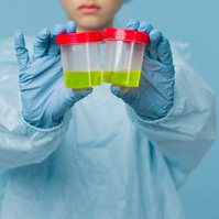 Ezek a vitaminok megváltoztatják a vizelet színét - ne aggódjon miatta!
