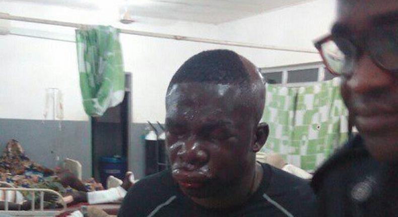 Police officer beaten by robbers