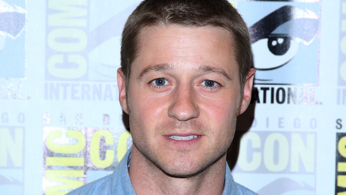 Ben McKenzie został ranny podczas pracy na planie serialu „Gotham”. Aktor zamieścił na swoim Instagramie zdjęcia ukazujące głęboka ranę na jego czole.