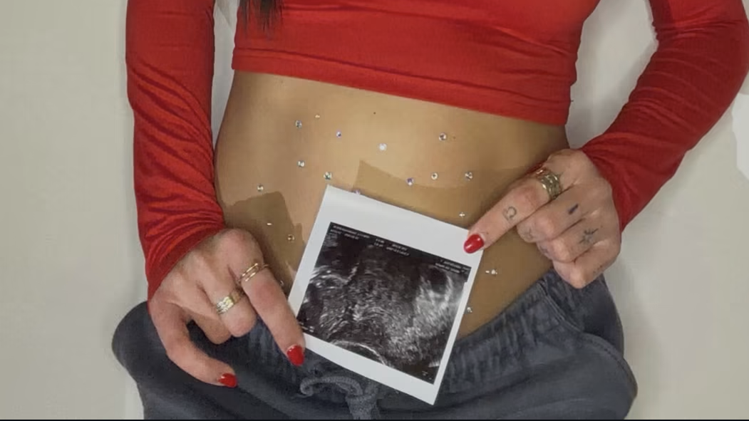 Michaela Doležalová čaká druhá dieťa. 