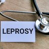 Prenos lepre zahteva dugotrajan, blizak i ponovljen kontakt sa osobom koja boluje od nje