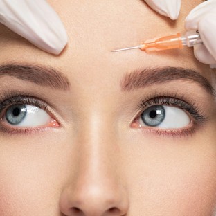 Mire jó a botox? Fejfájás és izzadás ellen is segíthet