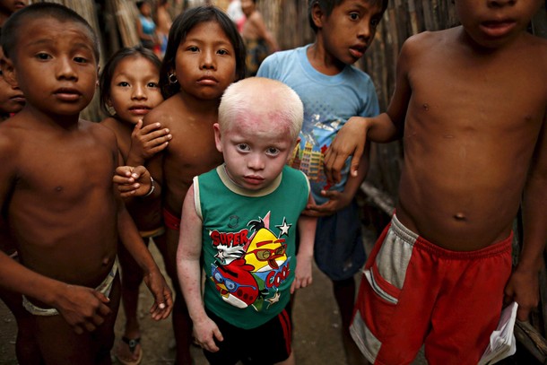 PANAMA-ALBINOS/WIDERIMAGE