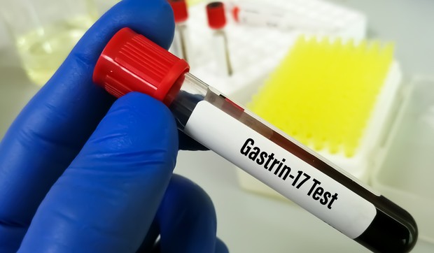 Gastrin, hormon koji reguliše varenje