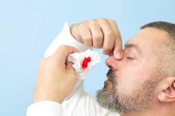 orrvérzés, tünetei, kezelése, diagnosztizálása, vizsgálat, vér ürülése az orrból, vér ürülése a garatba
