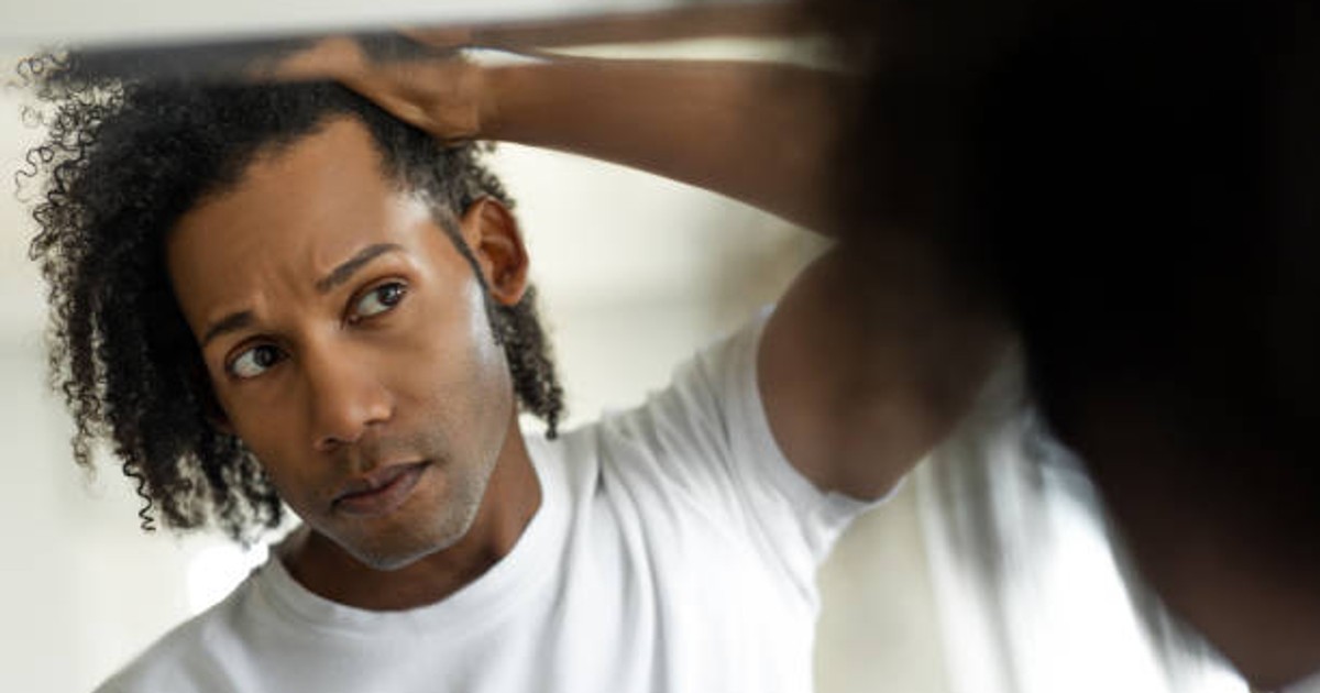 3 ways to fix your hairline | Pulse Ghana - Vimarsana News