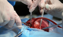 To jest dobry czas dla polskiej transplantologii - mówi dr Michał Zembala, kardiochirurg