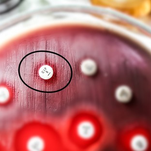 Elkeserítő eredmények: a jövő antibiotikumai hatástalanok lesznek a baktériumokkal szemben