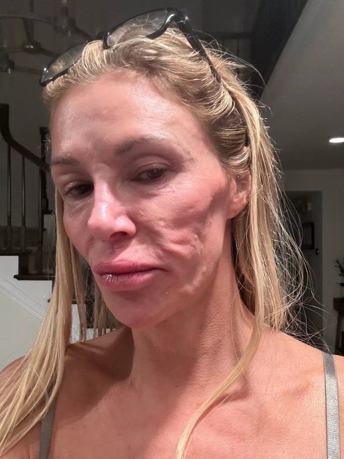Brandi Glanvil
