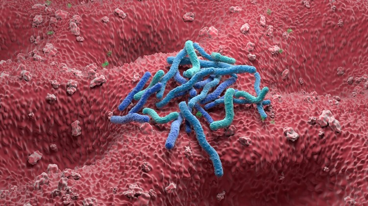 intuíció gyomorfekély oka helicobacter pylori