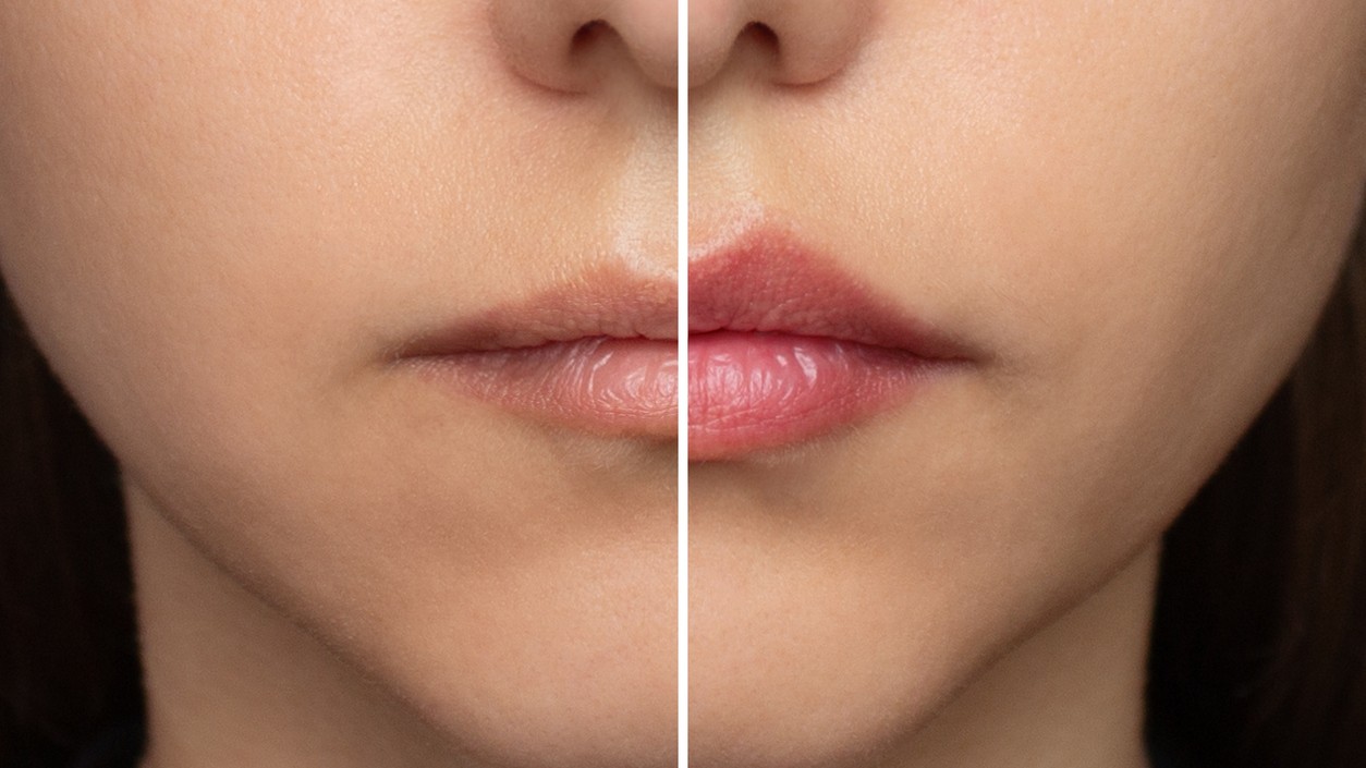 Rozdiel pred a po obkreslení kontúrkou: jemná technika dokáže pery opticky zväčšiť za pár minút.