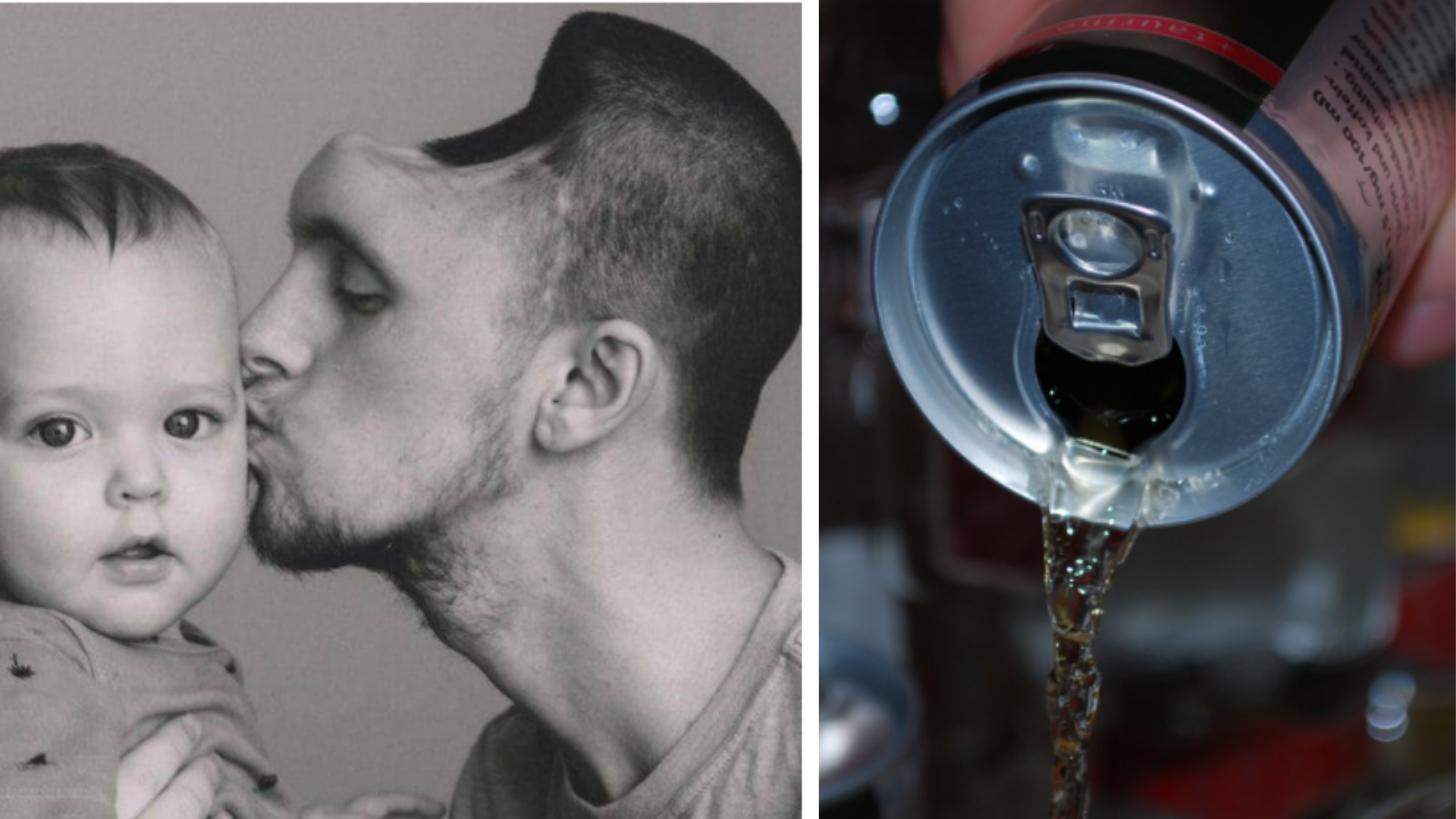 Austina stála konzumácia energeťákov takmer život