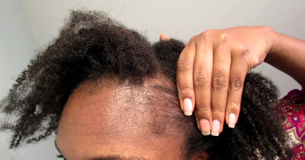 4 natural ways women can regrow hair on their bald head | Pulse Nigeria