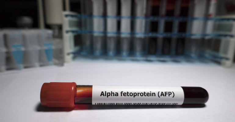 Alfa-fetoproteina (AF)