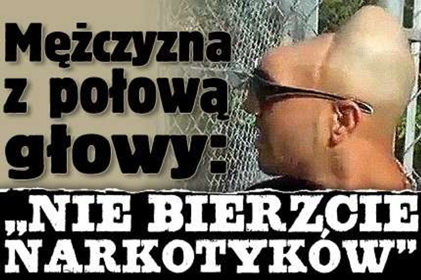 Mężczyzna z połową głowy: "Nie bierzcie narkotyków". FILM