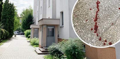 24-letnia Zuzanna postrzelona przez lokatorów. Sprawcy ataku usłyszeli zarzuty. Grozi im długa odsiadka