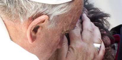 Zdeformowała go choroba. Papież przytulił go do piersi