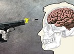 What really happens to the human body after getting shot