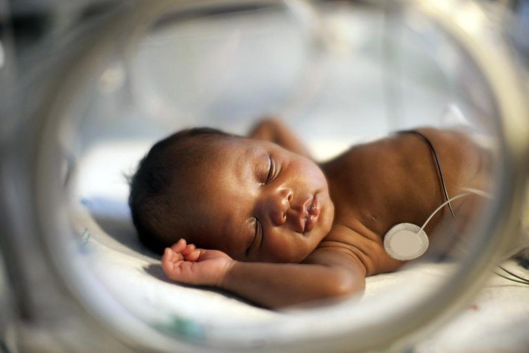Baby in incubator(Verywell Family) 