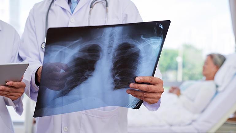 Pneumonia és cukorbetegség idősekben