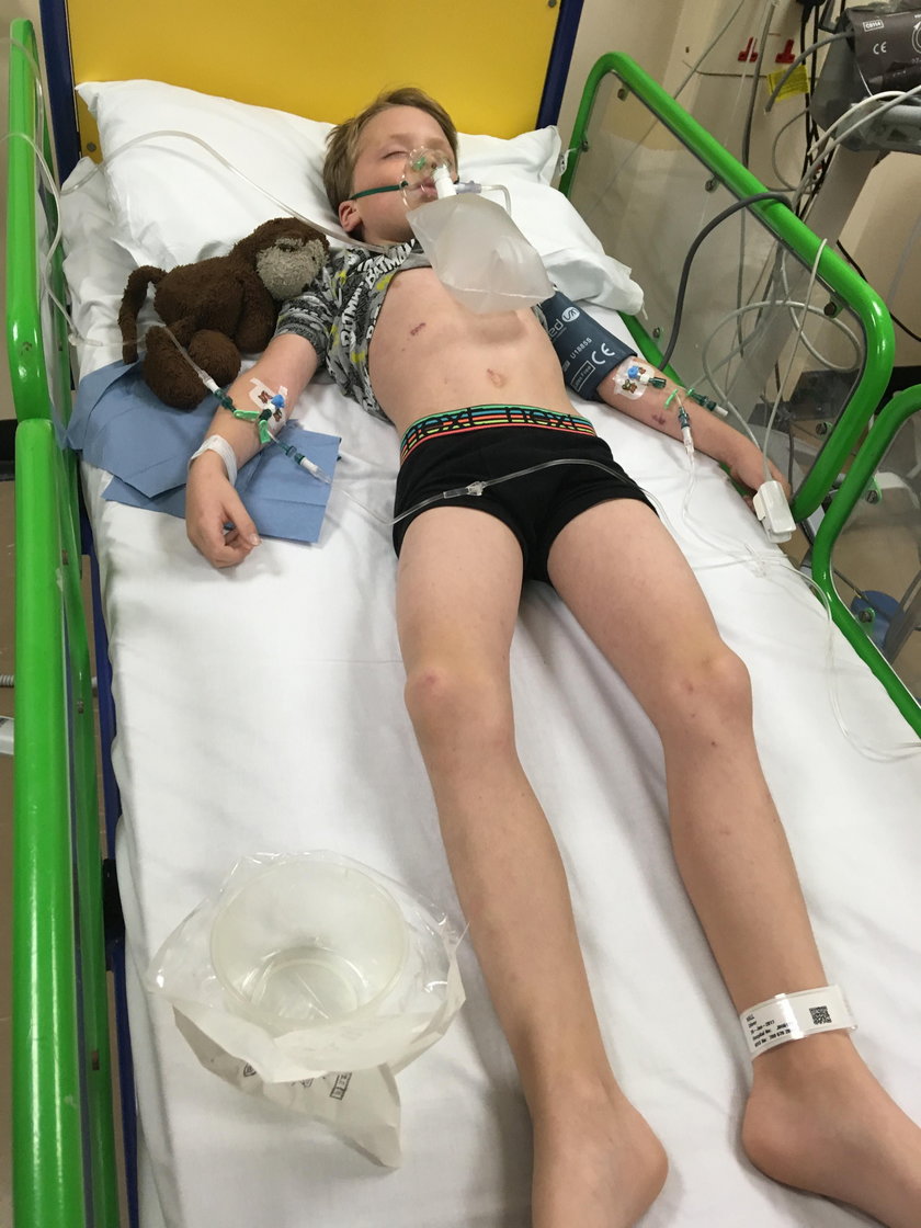 6-letni Oliver Hall na zapalenie opon mózgowo-rdzeniowych