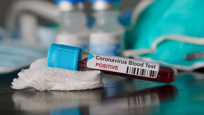 Coronaviru cases go up to 4,263 in Ghana