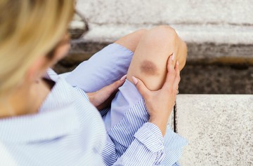 Tele van kék-zöld foltokkal a keze, lába pedig nem ütötte be? Ez lehet az oka