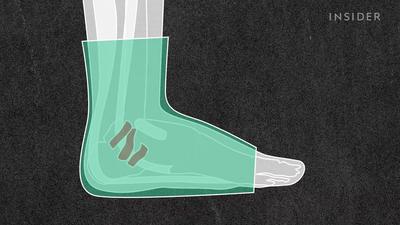 Podiatrists debunk 12 feet myths