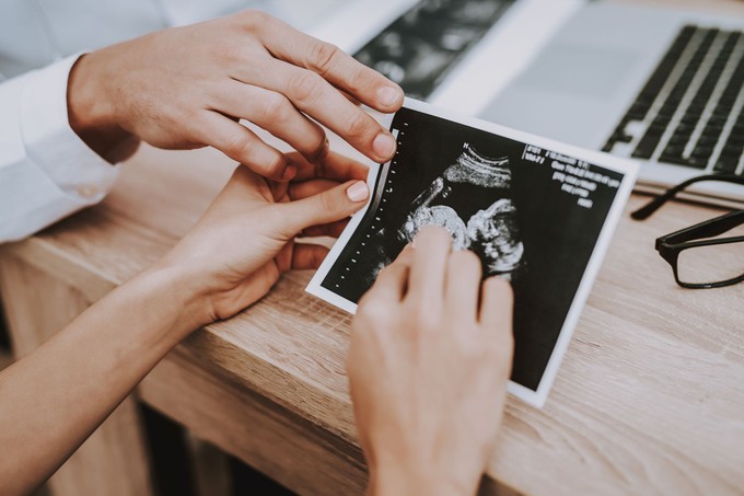 A kisbabám nyakára duplán rá van tekeredve a köldökzsinór, mit lehet tenni? Az orvos válaszol