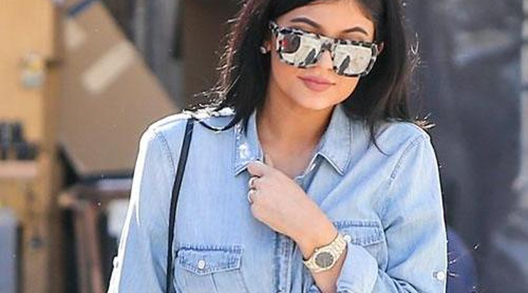 Kylie Jenner 11 milliót költött plasztikai műtétre!