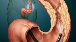 Terapia biologiczna na Colitis Ulcerosa