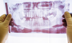 Pandemię widać też po naszych zębach. Prawie połowa Polaków unikała dentysty