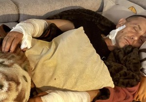 Psi lutalice napale bivšeg specijalca