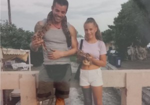 Marija Filipović je imala 6 godina kada joj je amputirana noga zbog sarkoma