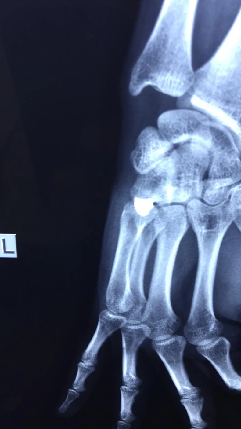 Mladići ranjavanje Štrpce