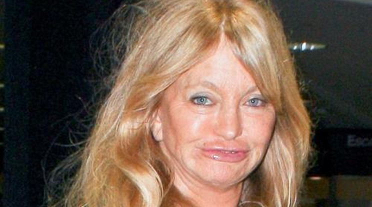 Ilyen szörnyen néz ki Goldie Hawn!